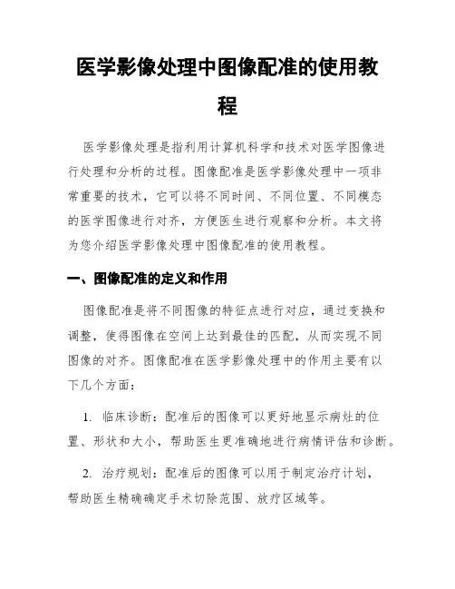 医学影像处理中图像配准的使用教程