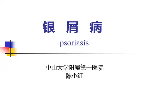 银屑病