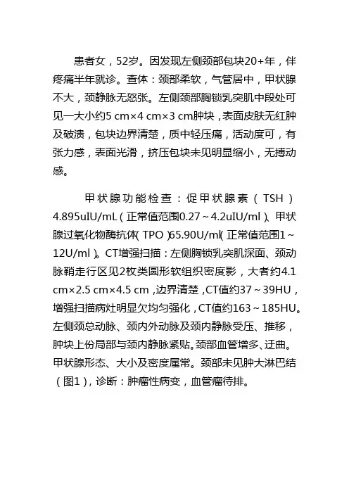 颈部异位甲状腺腺瘤