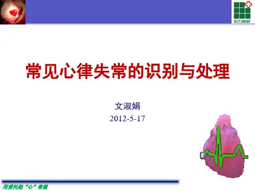 常见心律失常的识别与处理