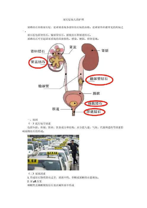 尿石症病人的护理