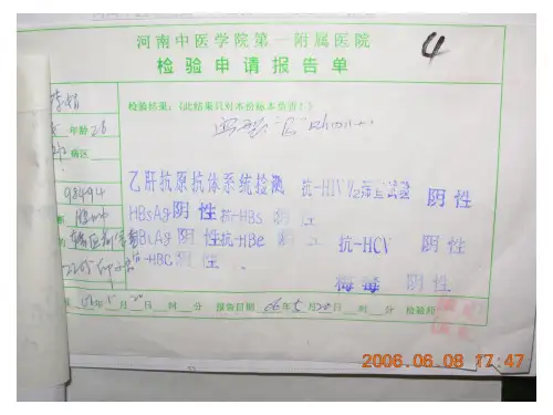 输血前有关检查PPT课件