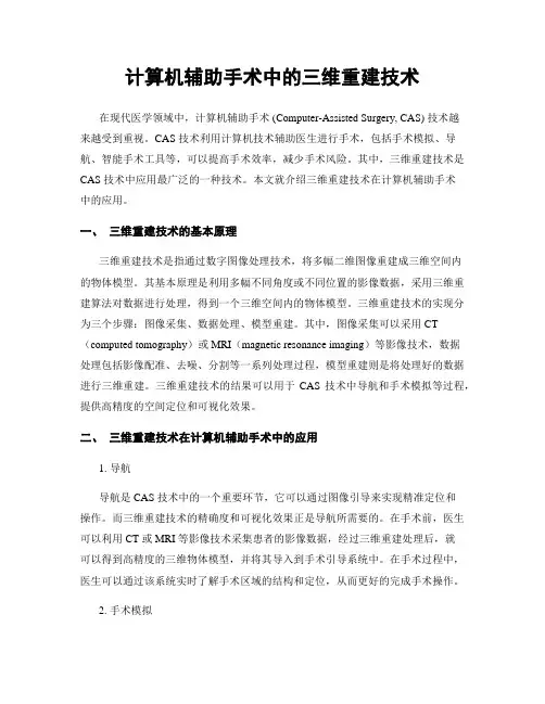 计算机辅助手术中的三维重建技术