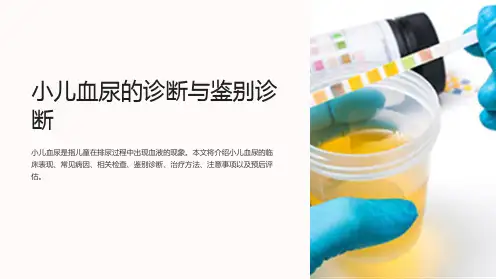小儿血尿的诊断与鉴别诊断