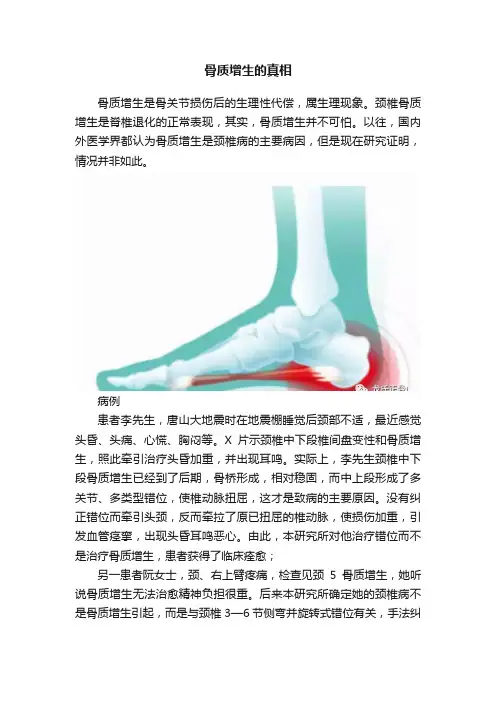 骨质增生的真相