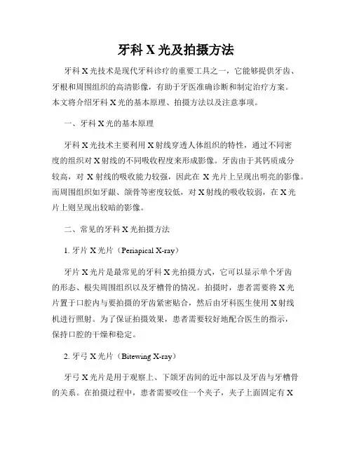 牙科X光及拍摄方法