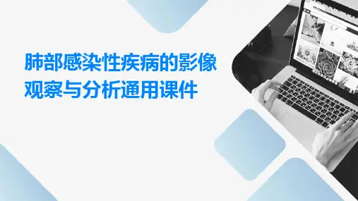 肺部感染性疾病的影像观察与分析通用课件