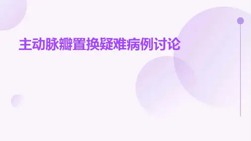 主动脉瓣置换疑难病例讨论