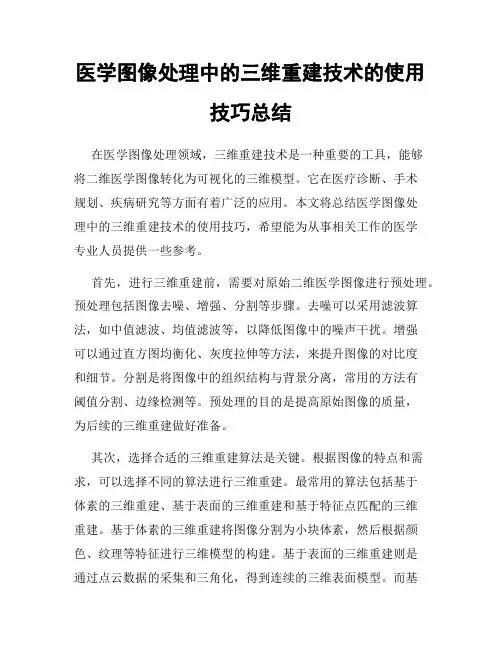 医学图像处理中的三维重建技术的使用技巧总结