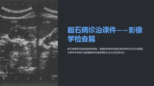 《胆石病诊治课件-影像学检查篇》