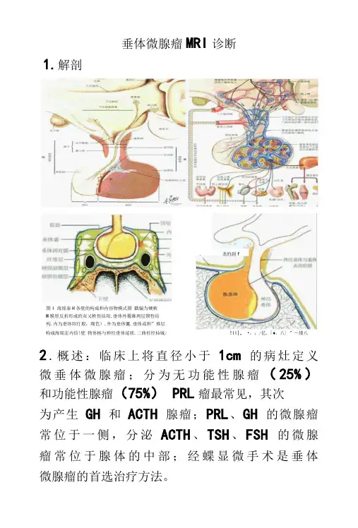 垂体微腺瘤影像诊断