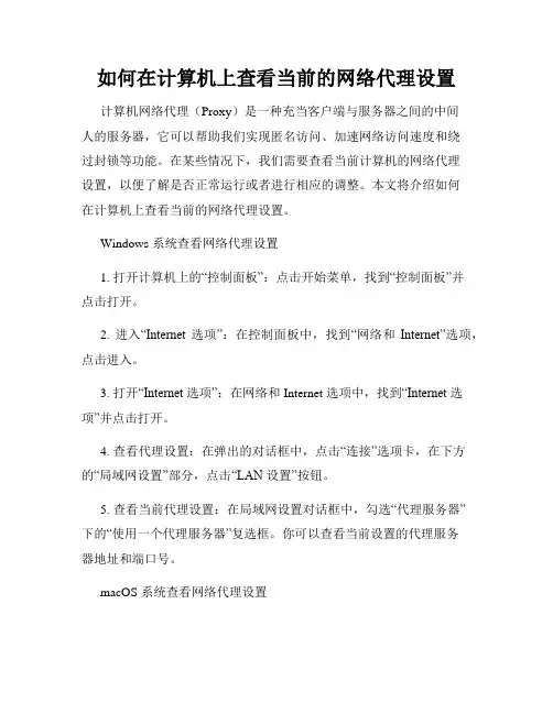 如何在计算机上查看当前的网络代理设置