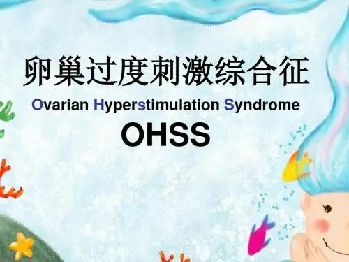 卵巢过度刺激综合症ppt课件