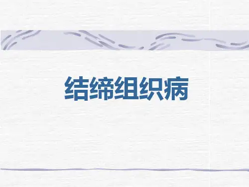 结缔组织病