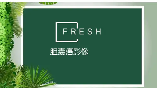 胆囊癌影像
