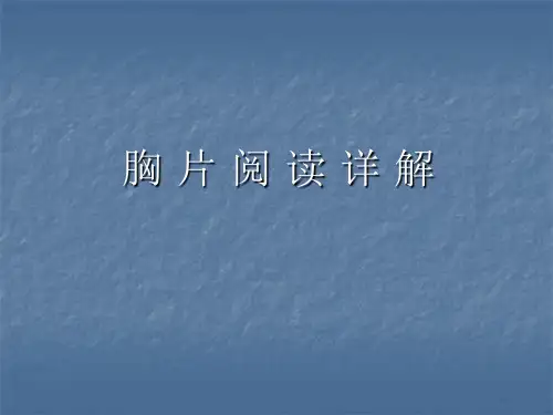 胸片阅读详解