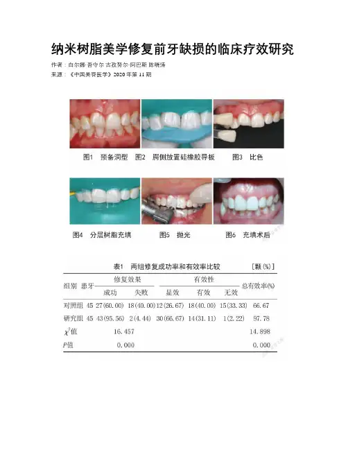 纳米树脂美学修复前牙缺损的临床疗效研究