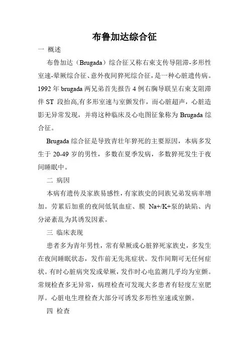 布鲁加达综合征
