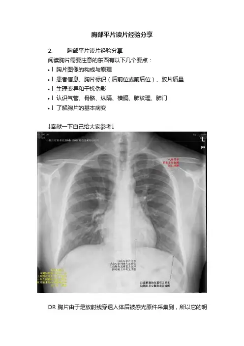 胸部平片读片经验分享