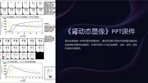 《肾动态显像》课件