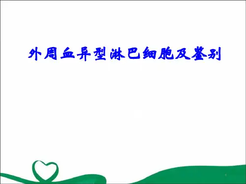 外周血异型淋巴细胞及鉴别PPT精选课件