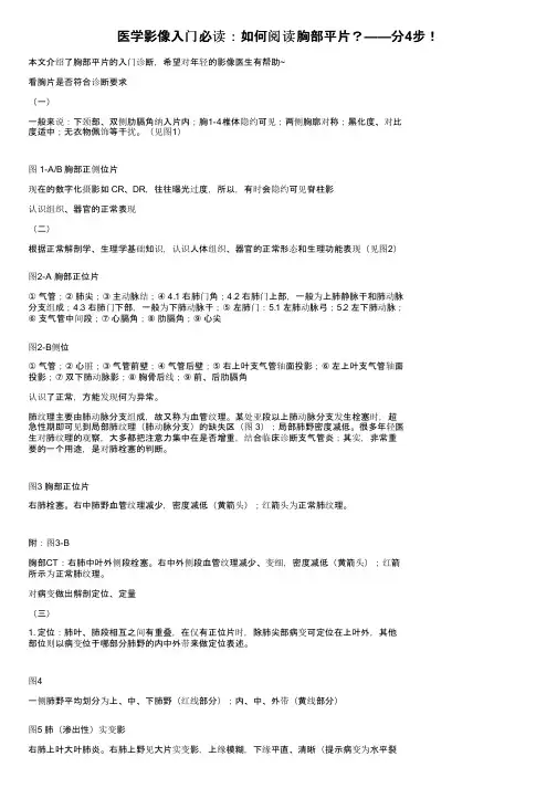 医学影像入门必读：如何阅读胸部平片？——分4步！