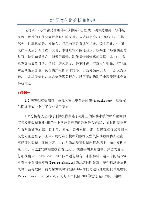 CT图像伪影分析和处理