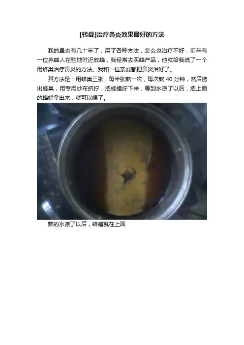 [转载]治疗鼻炎效果最好的方法