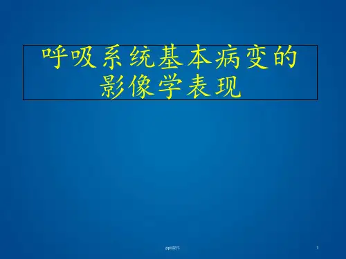呼吸系统基本病变的影像学表现【CT室】  ppt课件