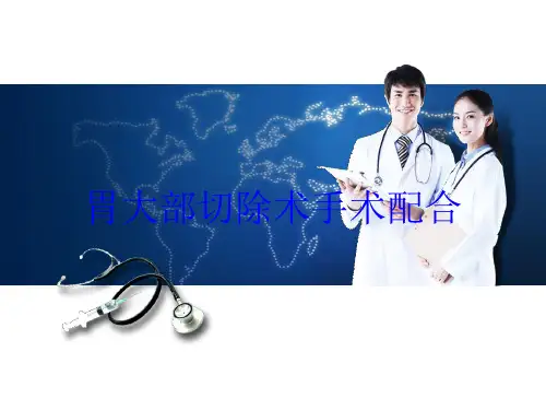 胃大部切除术手术配合培训课件