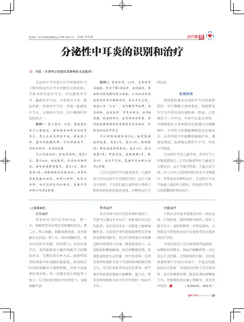 分泌性中耳炎的识别和治疗