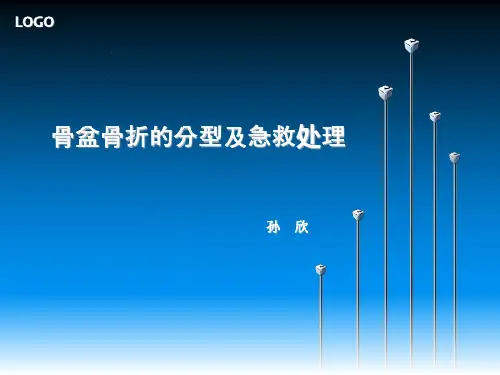 骨盆骨折(科室学习)