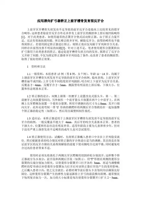 应用唇向扩弓器矫正上前牙槽骨发育型反牙合