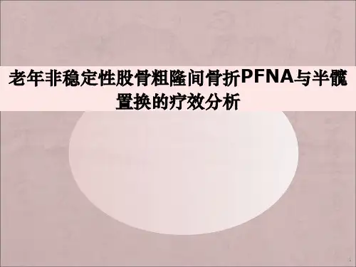 股骨粗隆间骨折治疗分析ppt课件