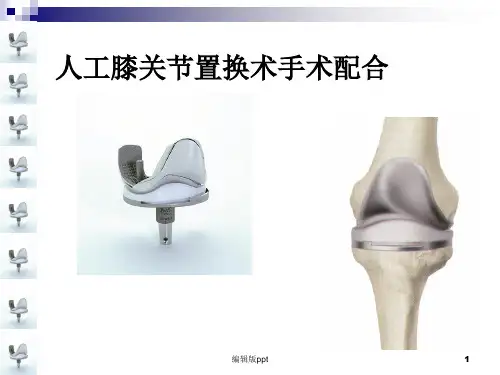 人工膝关节置换术手术配合PPT课件