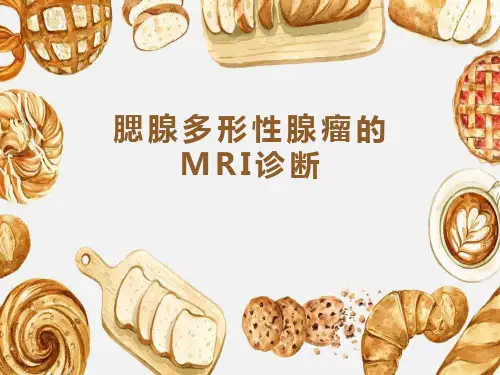 腮腺多形性腺瘤的MRI诊断