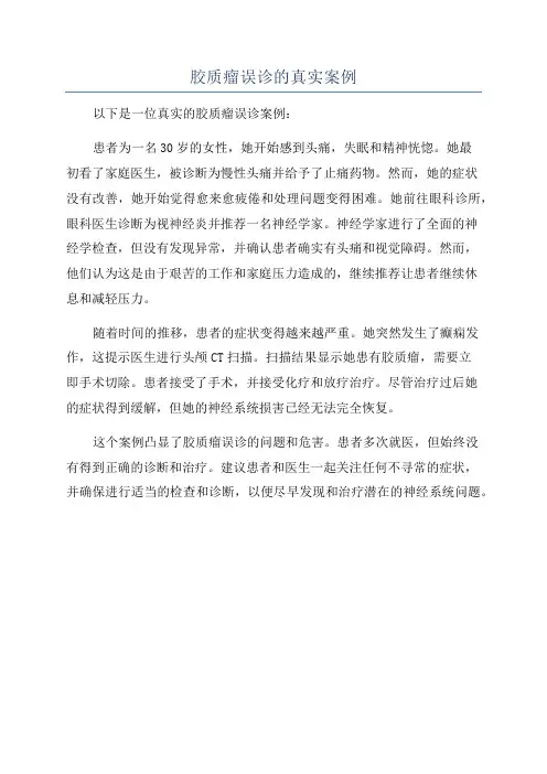 胶质瘤误诊的真实案例