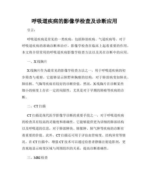 呼吸道疾病的影像学检查及诊断应用