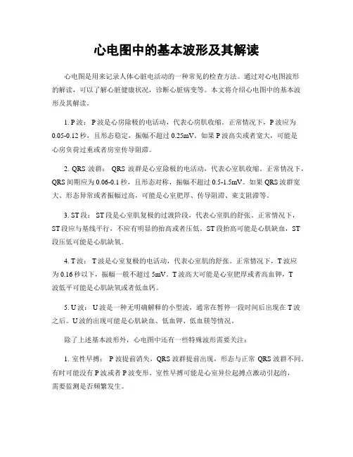 心电图中的基本波形及其解读