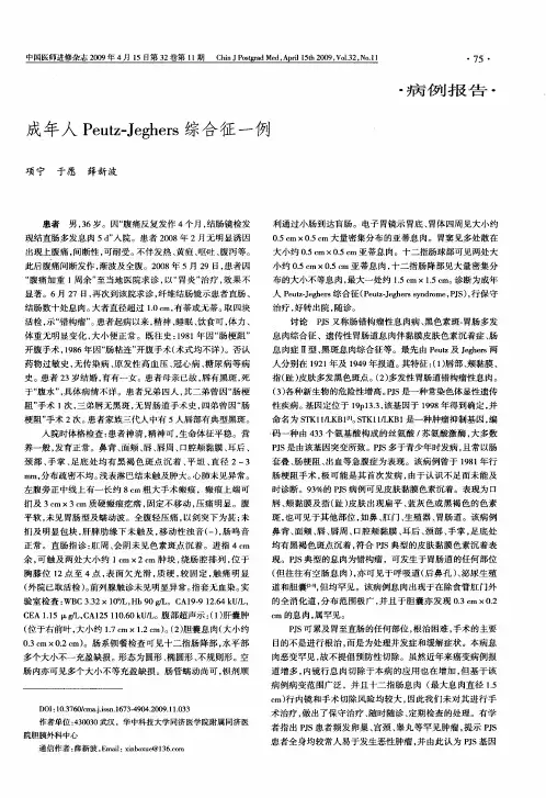 成年人Peutz—Jeghers综合征一例