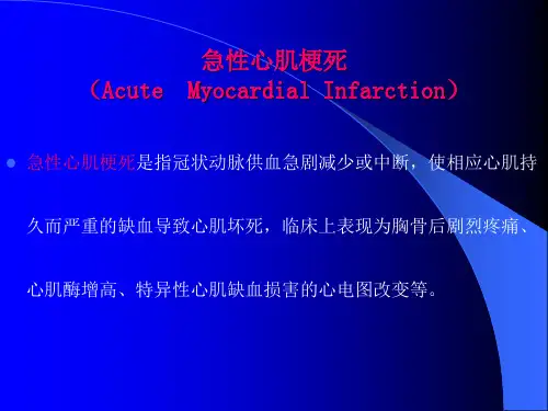 急性心肌梗死PPT课件