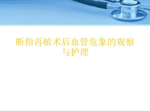 断指再植术后血管危象的观察与护理