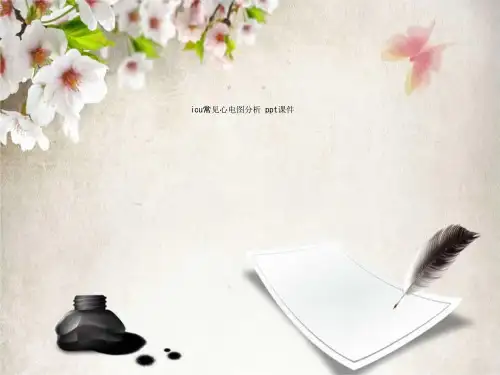 icu常见心电图分析 ppt课件