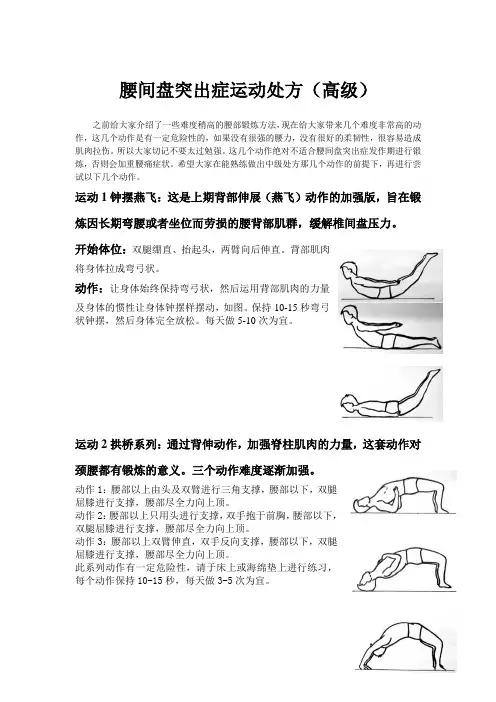 腰间盘突出症运动处方(高级)