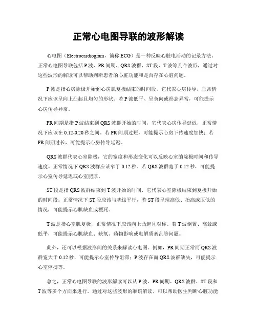 正常心电图导联的波形解读