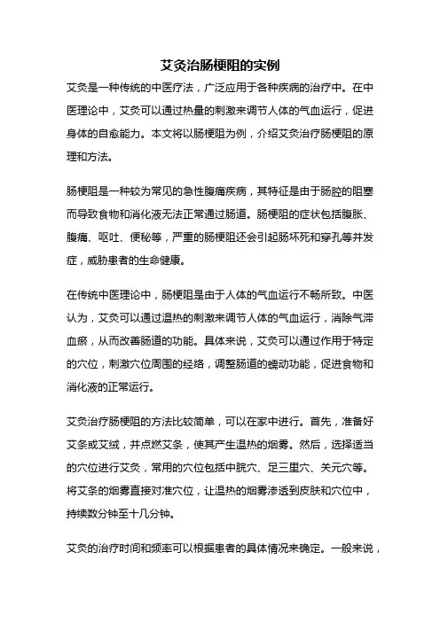 艾灸治肠梗阻的实例