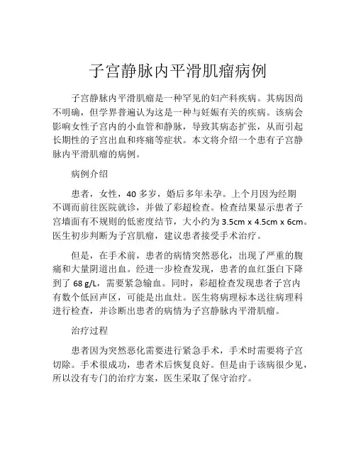 子宫静脉内平滑肌瘤病例