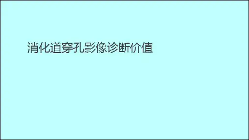 消化道穿孔影像诊断价值