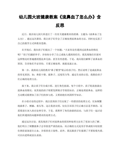 幼儿园大班健康教案《流鼻血了怎么办》含反思