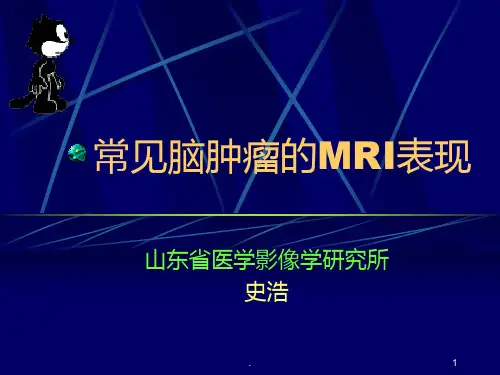 常见脑肿瘤的MRI表现